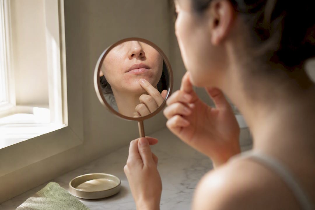 Woman examining sensitive skin around mouth