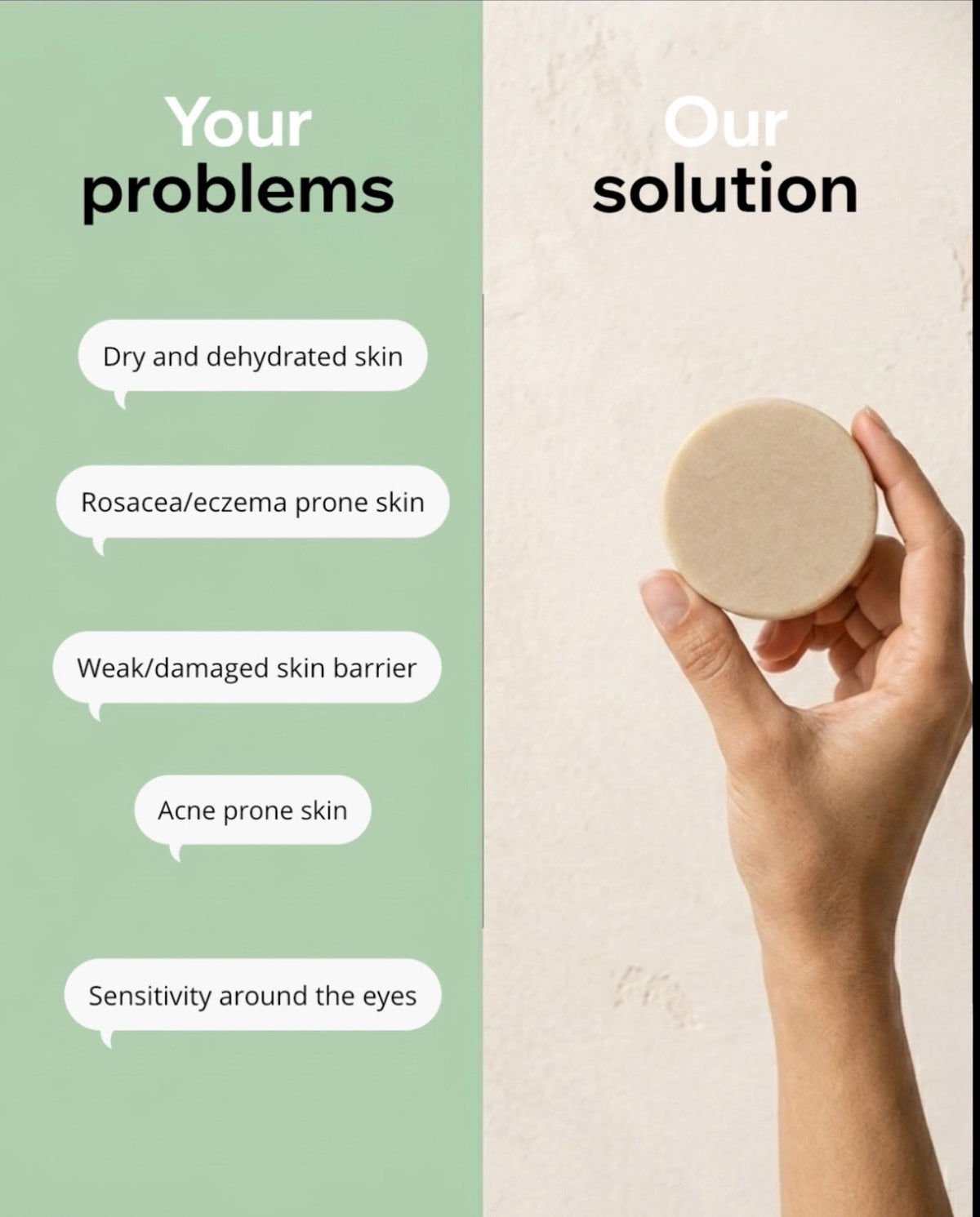 A hand holds a round beige skincare bar on the right side, next to a split graphic. The left side is light green with text reading 'Your problems' listing dry/dehydrated skin, rosacea/eczema-prone skin, weak/damaged skin barrier, acne-prone skin, and sensitivity around the eyes.